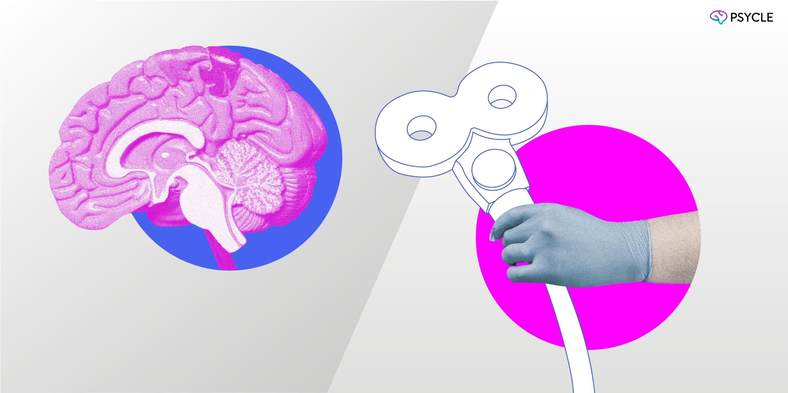 What is Transcranial Magnetic Stimulation?
