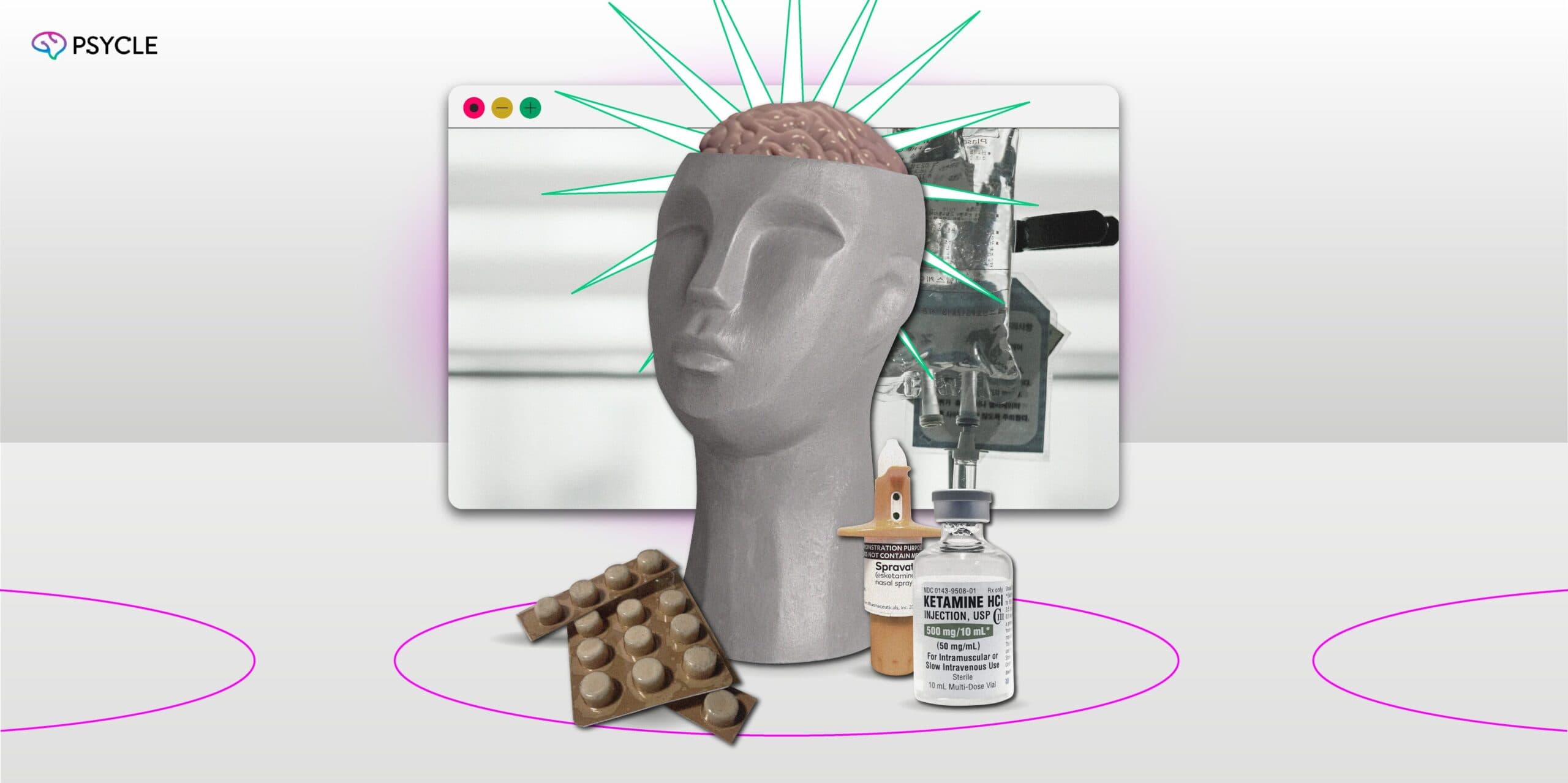 Understanding Ketamine's Psychedelic Effects: How it Influences Brain Chemistry