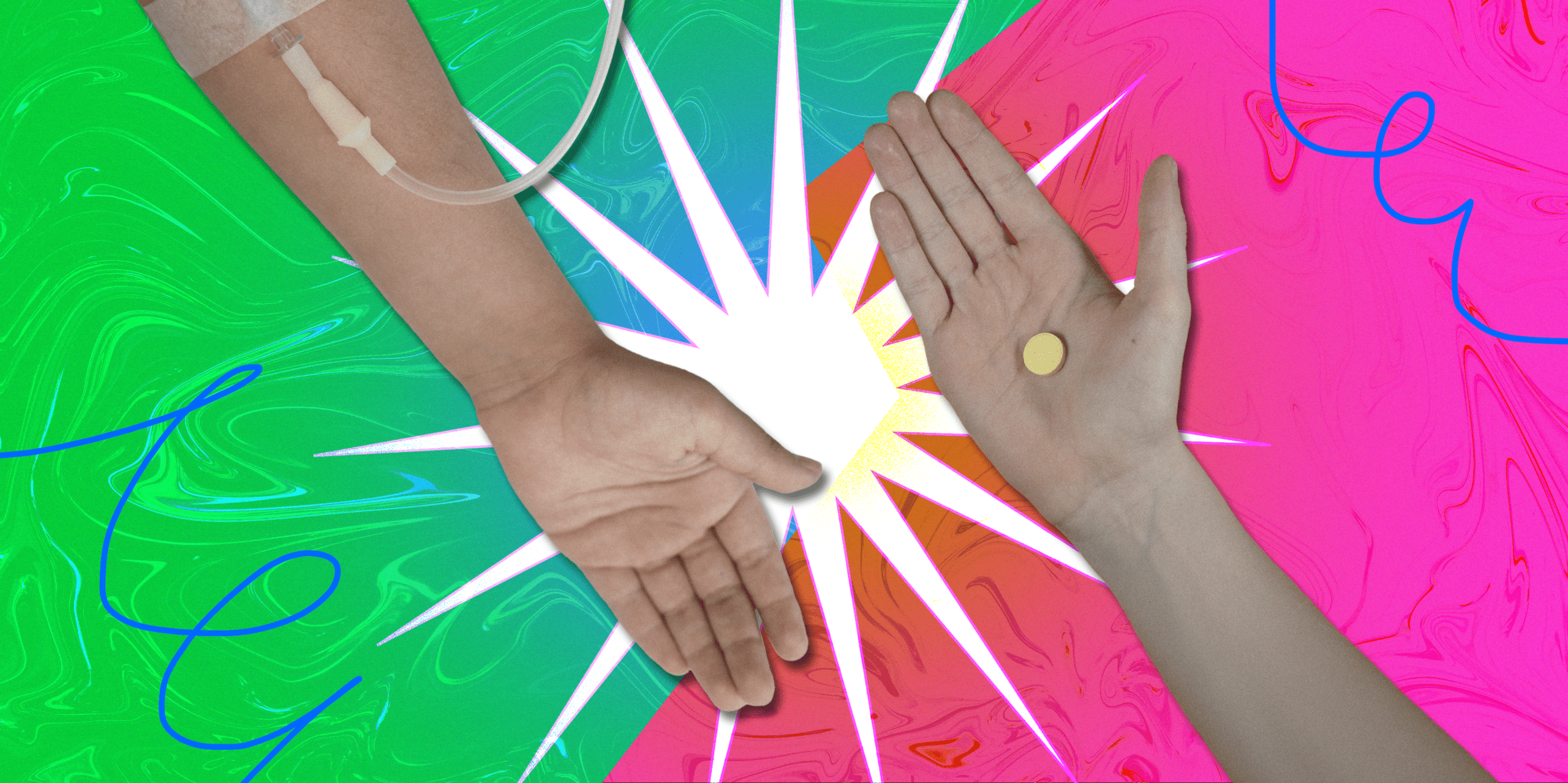 At-home oral vs Injectable Ketamine